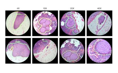 google ar microscope cancer featured website