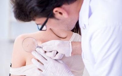 AI Skin Cancer Doctors