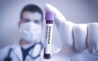 Coronavirus blood sample shutterstock website