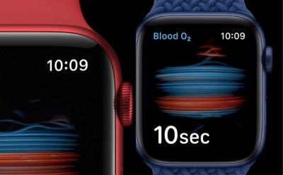 10 Best Apple Watch Series 6 Bands You Can Buy in 2020