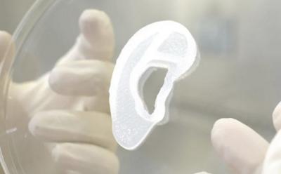 20-Year-Old Girl Becomes the First Person to Get a Functional 3D Printed Ear Made of Her Own Tissue!