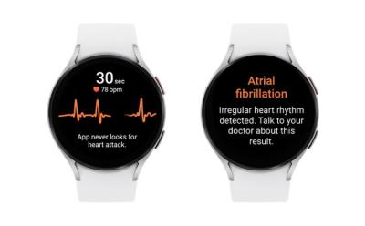 Samsung gains FDA approval for irregular heart rate monitoring