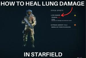 How to Quickly Heal Lung Damage in Starfield