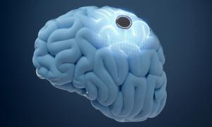 First Neuralink Brain Chip Implantee Encounters an Issue and It's Concerning