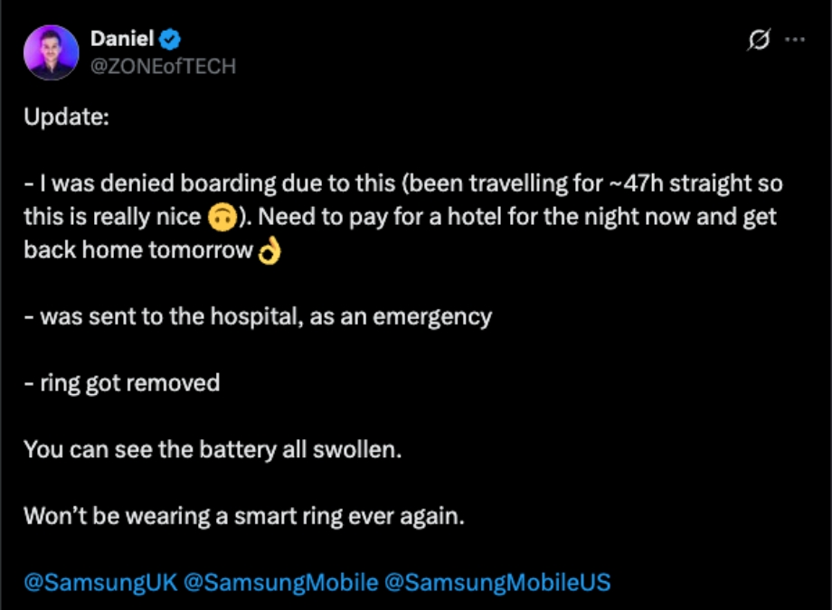 Daniel Update Post on X for Galaxy ring swelling issue