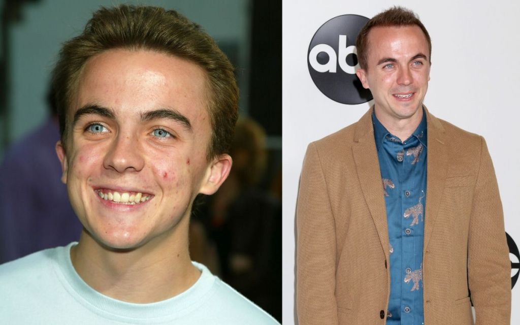 Frankie Muniz