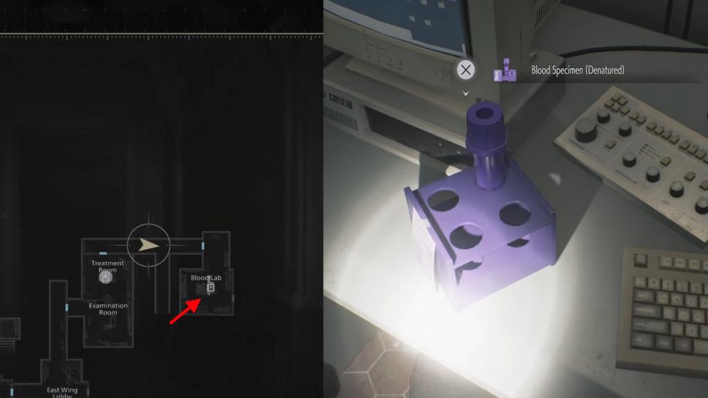 Resident Evil Requiem Analyzer Blood Specimen Denatured location